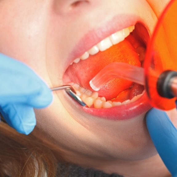 Close up of dental patient getting direct bonding treatment