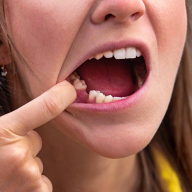 a person showing a missing tooth