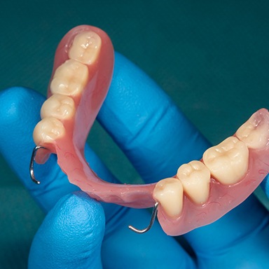 A gloved hand holding a partial denture