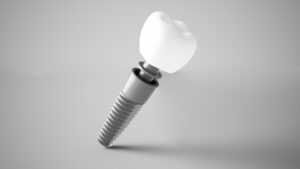 Dental implant on gray background